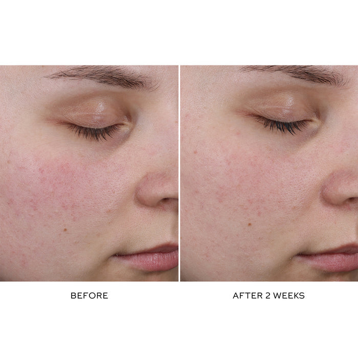 Westman Atelier Pore Refining Complex Serum before and after 2 weeks